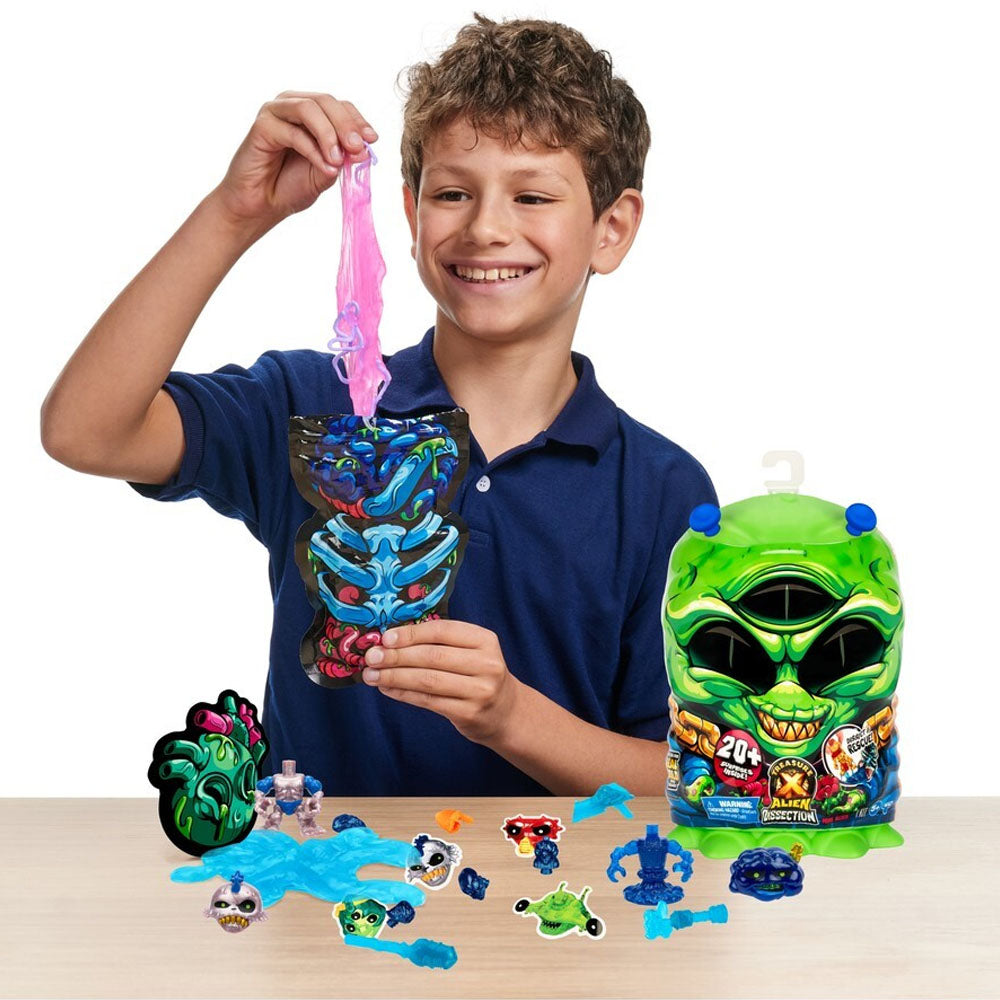 Treasure X S2 Mini Dissection